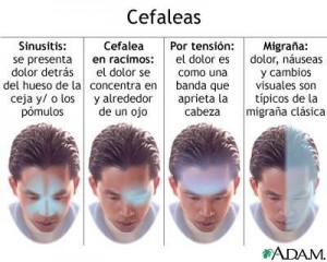 migrañas cefaleas